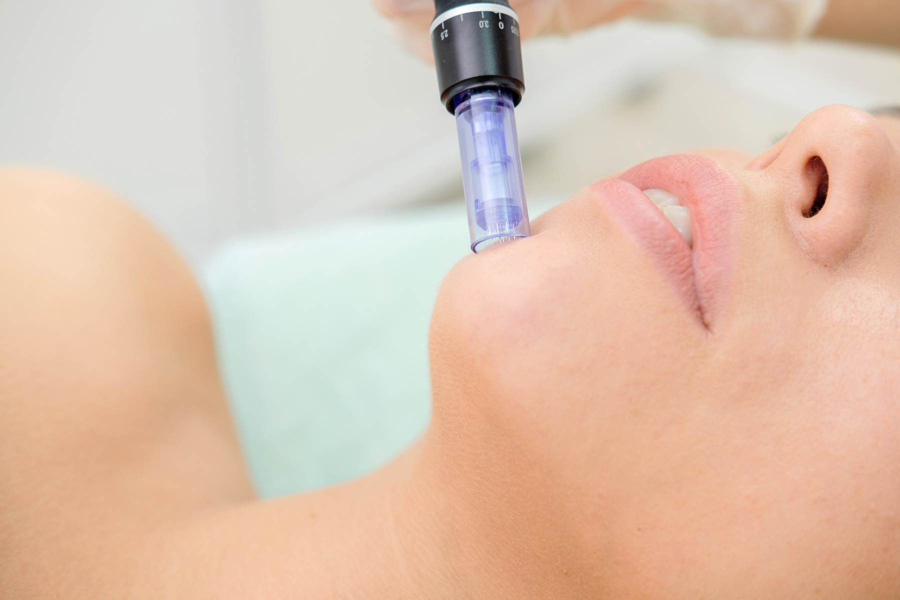 Microneedling & Hairneedling